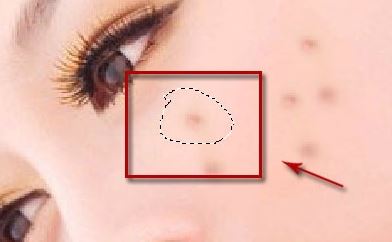 照片的臉上長(zhǎng)痘痘怎么調(diào)？教你照片臉上長(zhǎng)痘痘怎么去除