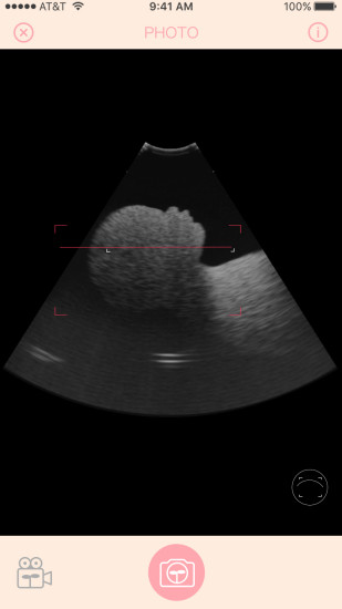 體內(nèi)相機(jī)